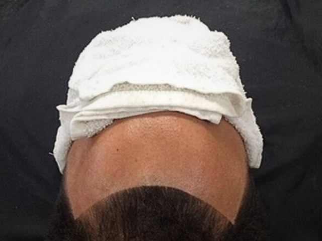 Head shape-up lineup